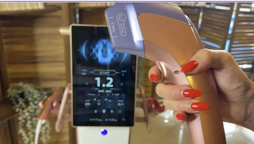 Therapist holding a HIFU handpiece with a 4.5mm SMAS-depth cartridge attached, ready to treat a GLP-1 body contouring client
